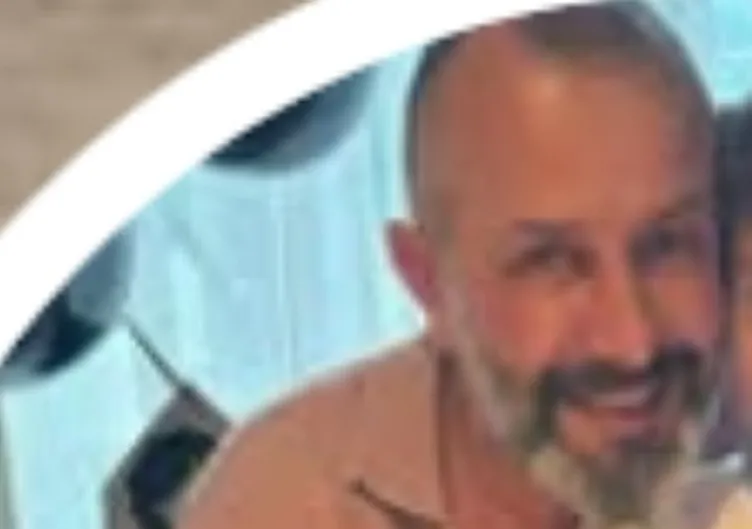 SON DAKİKA | 4 yıl sonra komadan çıkmıştı! Burçak Şişman’a SABAH ulaştı: Çenesi kırılınca yaşananları hakime yazıyla anlattı