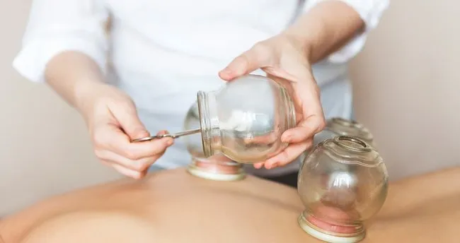 islak kupa terapisi hacamat nedir