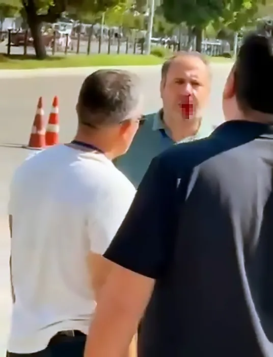 Eşi 4. kez sınavdan kalmıştı: Eğitmenin burnunu kıran öfkeli adam için karar verildi!