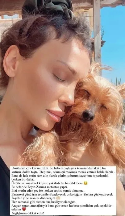 Kanserle mücadele eden şarkıcı Şimal’den yeni paylaşım: Güzel dualarınızı bekliyorum!