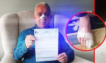 İstanbul’da komşu terörü: Çekip taciz ediyorlar! Yöneticinin burnu ve ayak parmakları kırıldı #istanbul