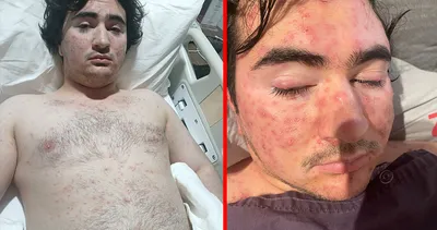 Özel hastanede insanlık ayıbı