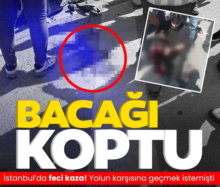 İstanbul’da feci kaza! Yolun karşısına geçmek istemişti: Bacağı koptu