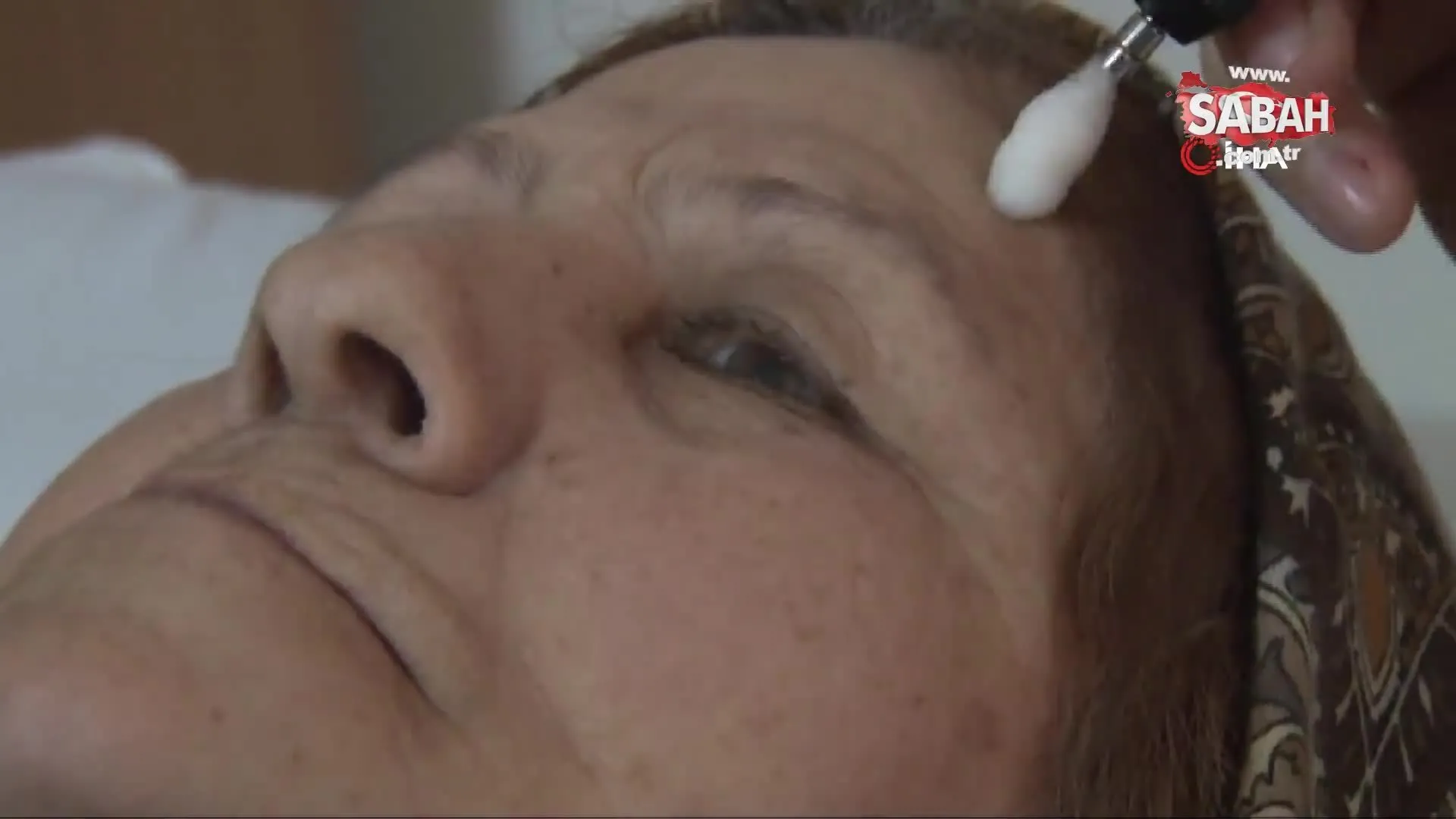 soguk hava yuz felcine sebep olur mu yuz felci nedir yuz felcinden nasil korunuruz