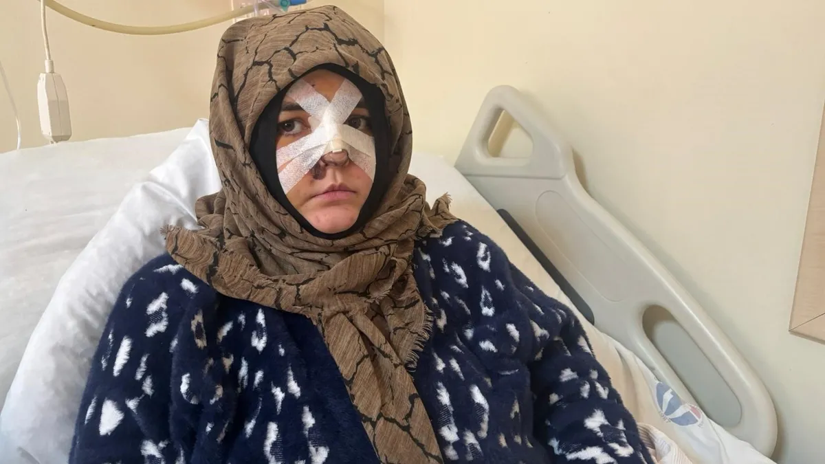 Gaziantep’de sokak ortasında öldüresiye dayak: Cani eşin yaşattıklarını böyle anlattı! ‘Taşla yüzüme defalarca…’ Gaziantep’de sokak ortasında öldüresiye dayak: Cani eşin yaşattıklarını böyle anlattı! ‘Taşla yüzüme defalarca…’