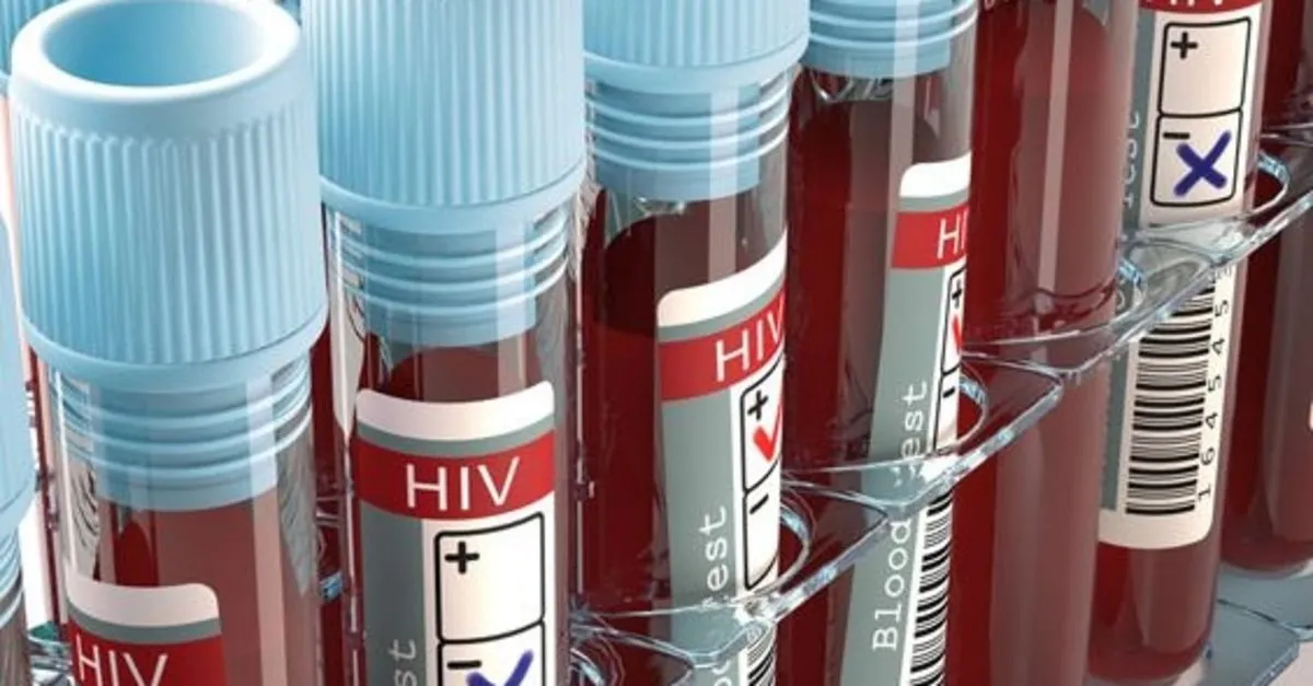 aids hiv testi ne zaman