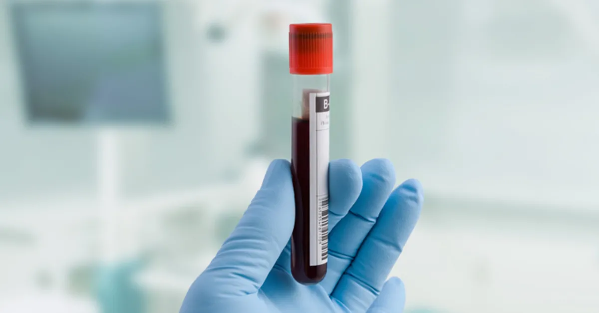 rbc nedir kan tahlilinde rbc dusuklugu