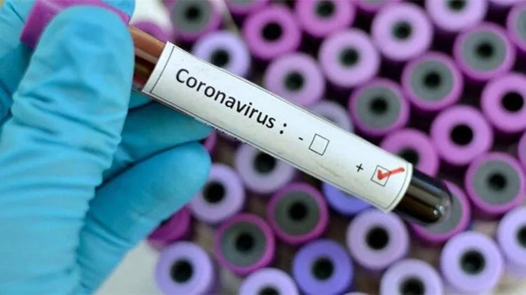 Corona virüsü aşısı ile ilgili son dakika haberi: Deneme süreci bugün başlıyor