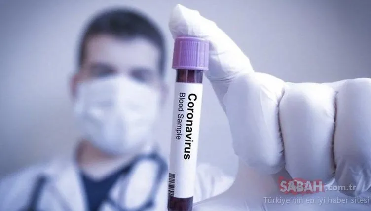 Son Dakika Haberi: Almanların 8 yıl önce hazırladığı corona virüsü raporu dünyayı sarstı! Mutasyona uğrayacak