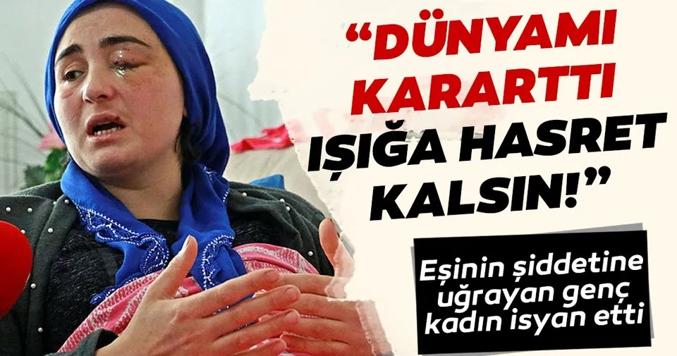 Son dakika haberi Eşinin şiddeti yüzünden gözünü kaybetti Son dakika haberi Eşinin şiddeti yüzünden gözünü kaybetti