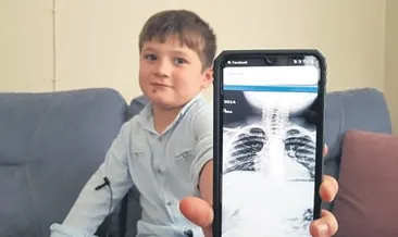 Ali’nin yuttuğu para çıkarıldı