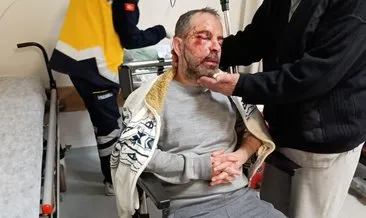 Konya'da sokak köpeği dehşeti: 6-7 tanesi birden saldırdı! #konya