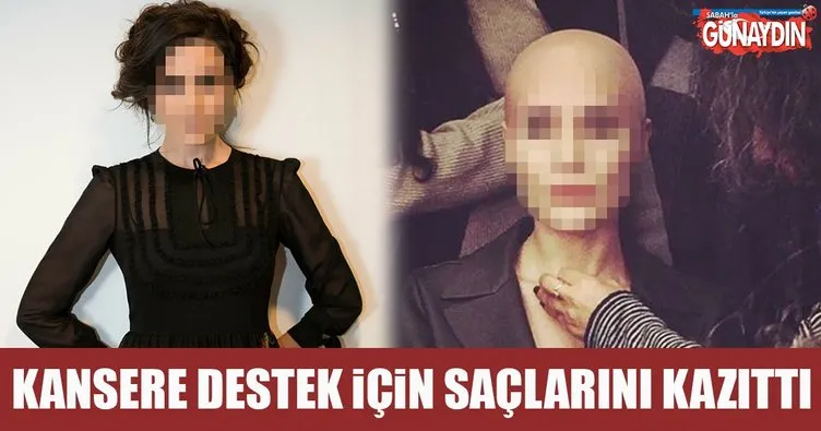 Belçim Bilgin Erdoğan kansere destek olmak için saçını kazıttı