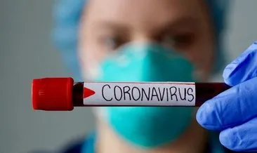 Belirti göstermeyen hastalara corona virüs teşhisi nasıl konuluyor?