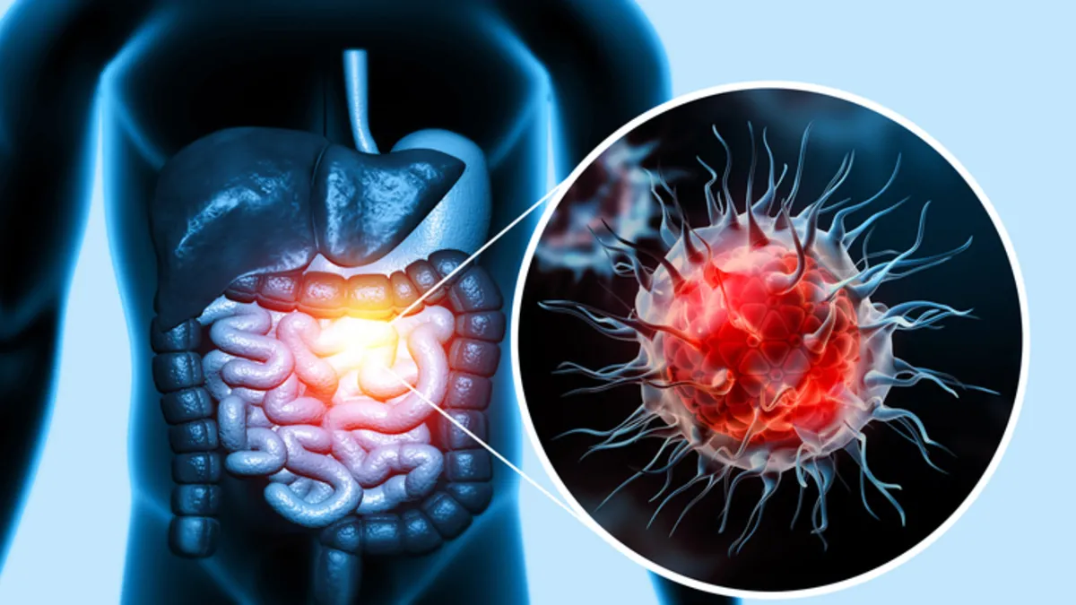 Kanserden korunmanın anahtarı bu alışkanlıklarda saklı Kanserden korunmanın anahtarı bu alışkanlıklarda saklı