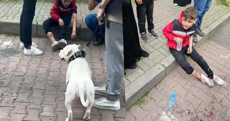 İstanbul’da korkunç olay! Başıboş köpek 12 yaşındaki çocuğu ısırdı!