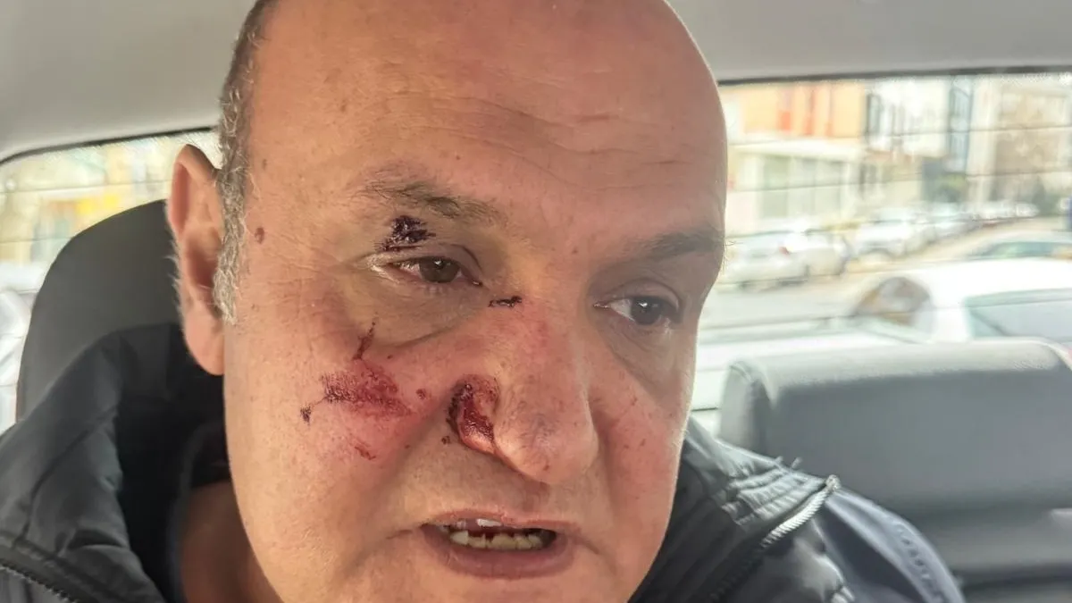 Avcılar’da kaldırıma park eden sürücüden akılalmaz savunma: Zabıtaya yumruklu saldırı! Avcılar’da kaldırıma park eden sürücüden akılalmaz savunma: Zabıtaya yumruklu saldırı!