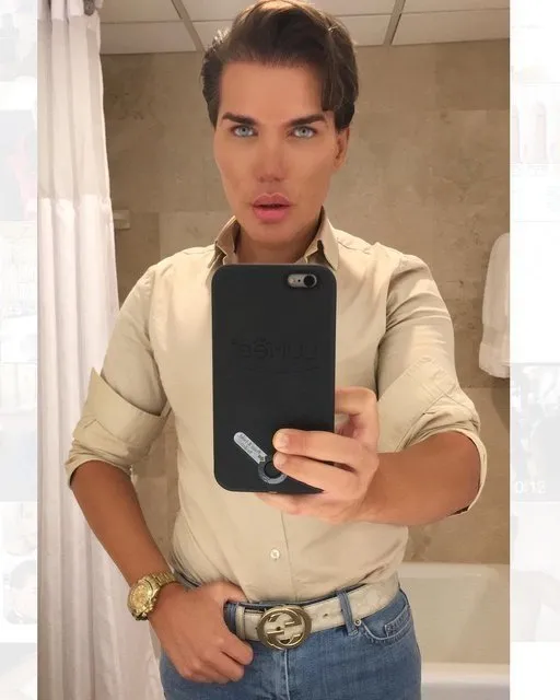 İşte Ken Bebek Rodrigo Alves'in estetiksiz hali