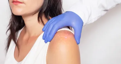 Güneş lekelerinden korunmak için...