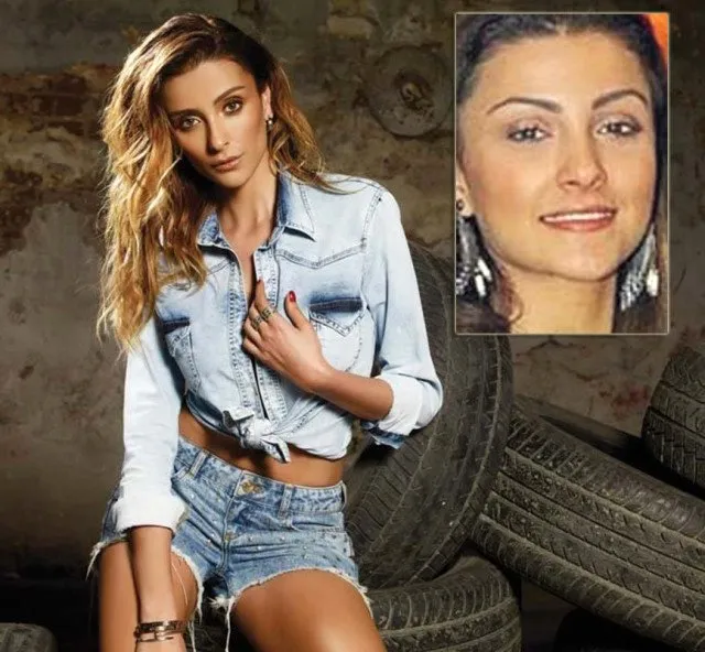 Özge Ulusoy hiçbir yerimde estetik yok diyordu ama… Sayfa 4 Son