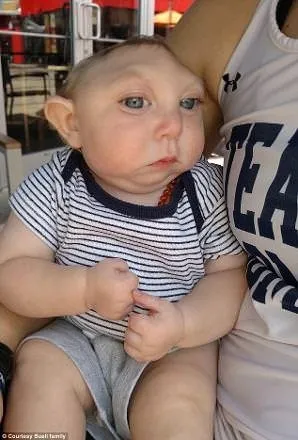 Mucize bebek 1 yaşında