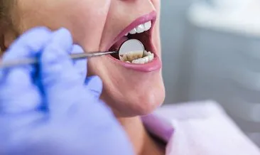 Ağız ve diş enfeksiyonları Kovid-19’u şiddetlendiriyor