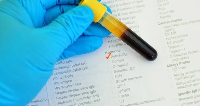 İkiz Gebelikte Beta HCG Değerleri Hesaplama - Hafta Hafta İkiz Gebelikte Beta HCG Kaç Olmalı?