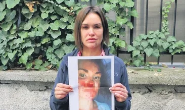 Güzellik uzmanına koca şiddeti