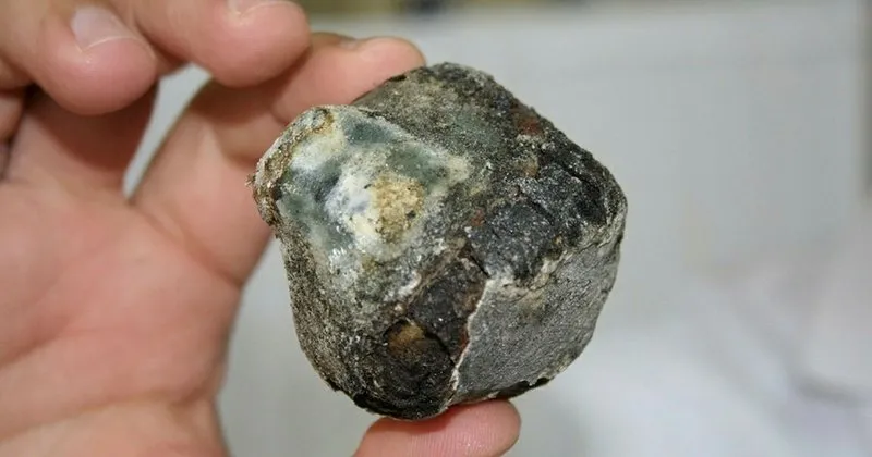 safra kesesi tasi belirtileri nelerdir