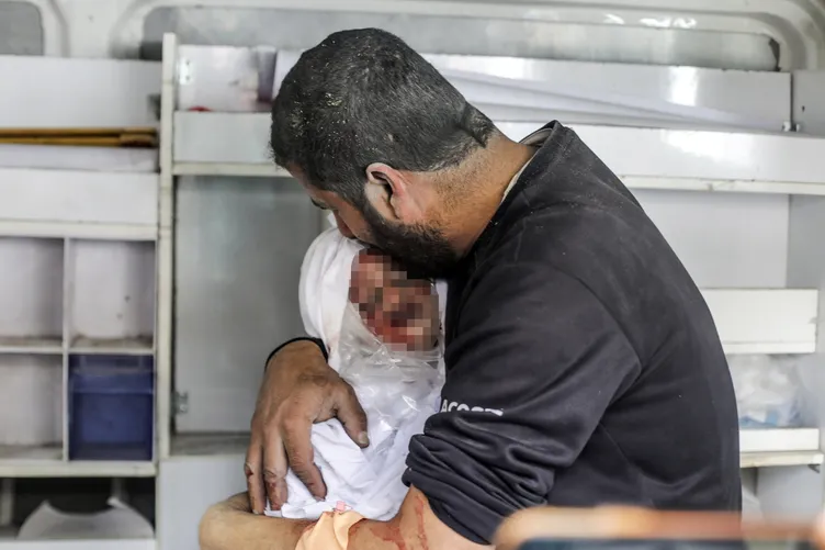 SON DAKİKA | Gazze’deki vahşetin boyutunu hastanedeki doktorlar anlattı: Yaralı çocuklar acıdan inliyordu