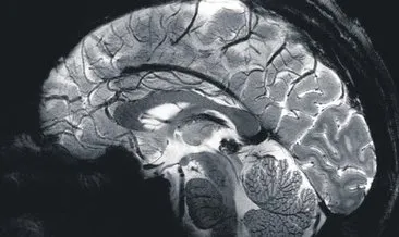 İnsan beyninin en detaylı hali ilk kez görüntülendi