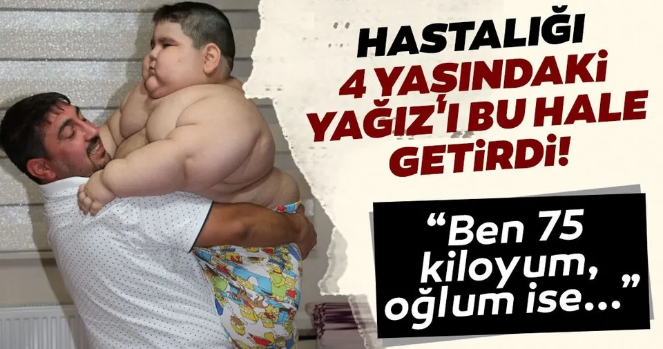 4 Yasinda 70 Kiloya Ulasan Yagiz Yardim Bekliyor Son Dakika Haberler