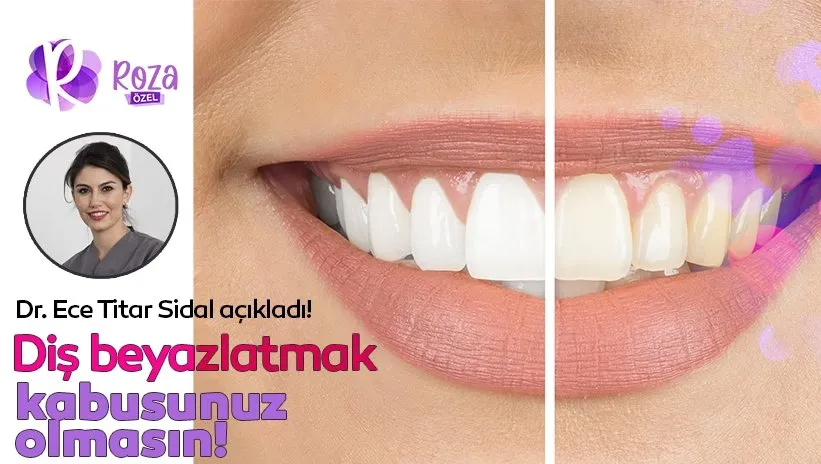 Dr. Ece Tatar Sidal diş beyazlatmanın sırlarını açıkladı!