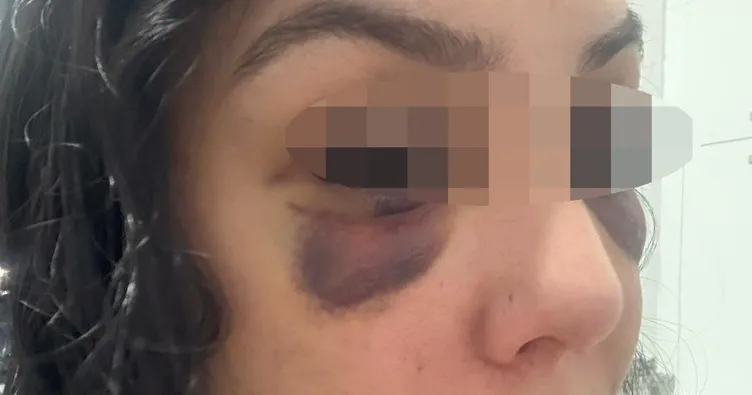 Eğlence merkezinde darp dehşeti