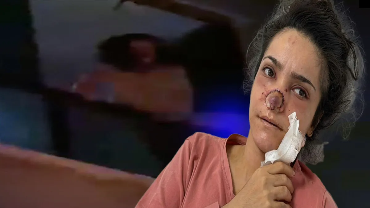 Manisa'da cani koca dehşeti! Tartıştığı eşinin burnunu koparmıştı: "Canımın acısıyla balkondan atlayacaktım!" Manisa'da cani koca dehşeti! Tartıştığı eşinin burnunu koparmıştı: "Canımın acısıyla balkondan atlayacaktım!"