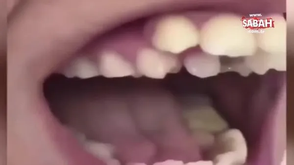 Dişleri doktoru bile şaşkına çevirdi!