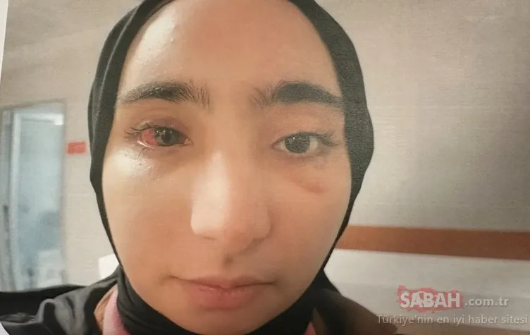 İstanbul’un göbeğinde dehşet! Kız çocuğunu kabloyla bağlayıp öldüresiye dövdü