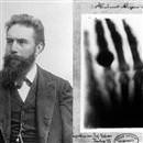 Fizikçi Wilhelm Conrad Röntgen, kendi adının verildiği cihazı icat etti