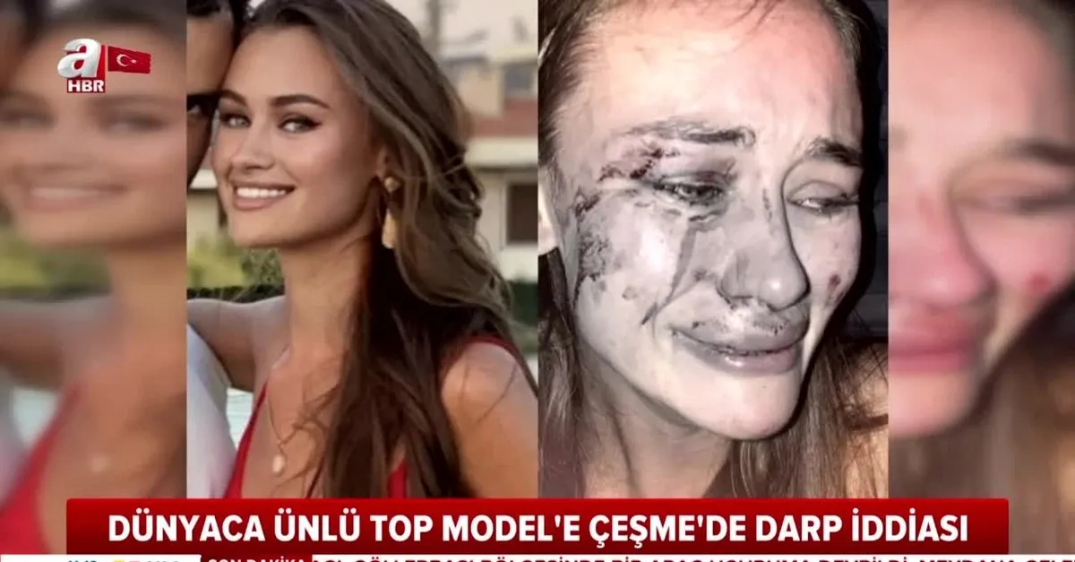 Izmir Cesme De Plajda Dunyaca Unlu Top Model Daria Kyryliuk A Feci Dayak Video Videosunu Izle Son Dakika Haberleri