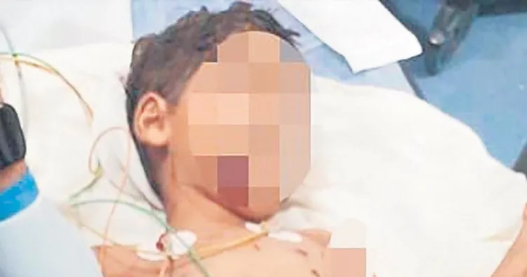 Sokak köpekleri bu hale getirdi