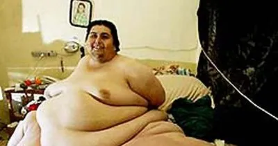 Dünyanın en kilolu insanı unvanını kimseye vermiyor! 12 yaşında 121 kiloydu şu anda ise...