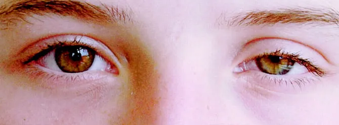 Akciğer kanserinin 10 belirtisi