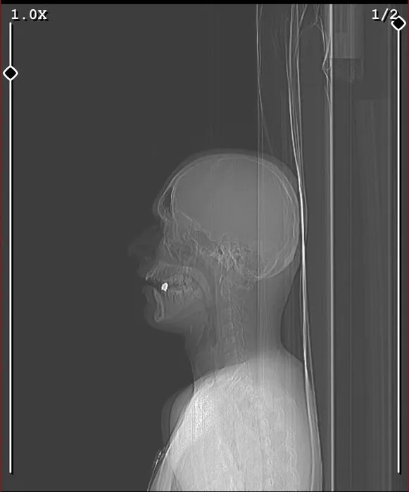 Boynundan girdi ağzında kaldı! İstanbul’da akıllara durgunluk veren olay