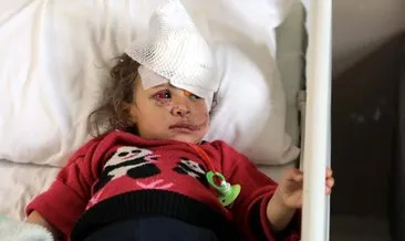 Şanlıurfa'da eşeğin ısırdığı küçük Fatma'ya yeni göz kapağı yapıldı #gaziantep