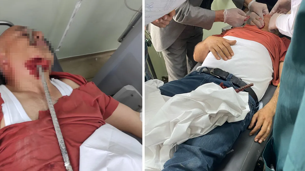 İskenderun’da feci kaza: İşçinin yüzüne inşaat demiri saplandı! İskenderun’da feci kaza: İşçinin yüzüne inşaat demiri saplandı!