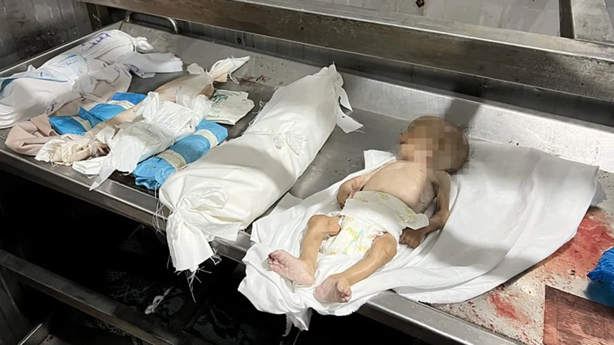 Ölümden Ölüme Koşuyoruz: İnsanlığın Bitmeyen Çilesi
