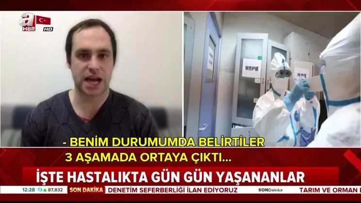 Corona virüsünü nasıl yendiğini anlattı! Hastalığın ilk belirtisi... | Video