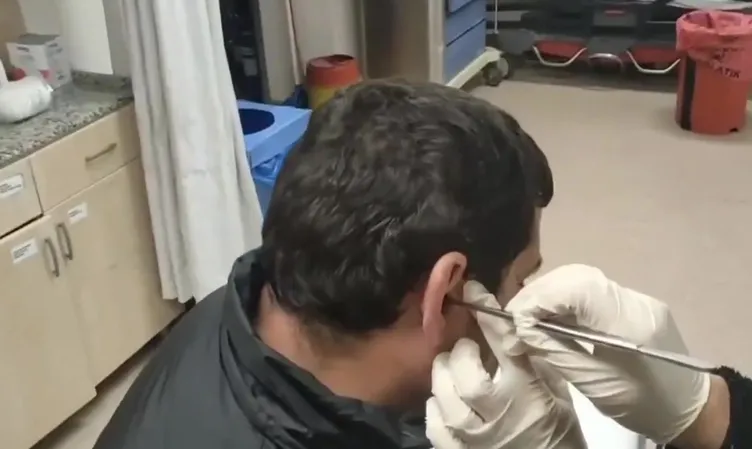 Ehliyet sınavında kopya skandalı: Karın bölgesinden çıkanlar şoke etti!