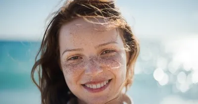 Güneş lekelerine çözüm!