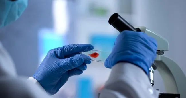 aids nedir nasil bulasir aids